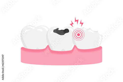 cavity teeth vector illustration. toothache icon sign symbol