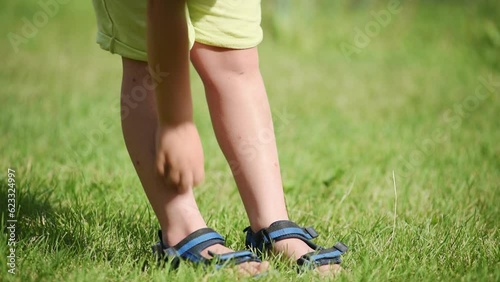 child scratching mosquito bites on summer background