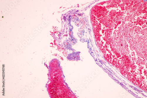 Showing Light micrograph of the Trachea, Thymus, Parathyroid gland and Tonsil  human under the microscope for education in the laboratory. photo