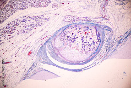 Showing Light micrograph of the Trachea, Thymus, Parathyroid gland and Tonsil human under the microscope for education in the laboratory.