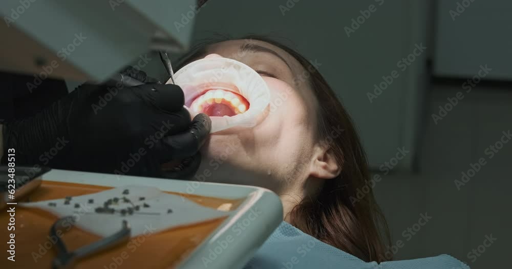 Dentist drills teeth of patient lying on chair. Shelf with braces removed. Mouth blowing with compressed air.