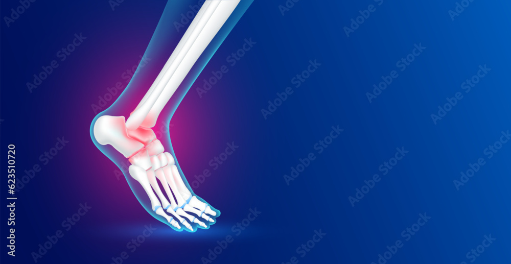 Ankle bone foot traumas and arthritis joint cartilage side on blue background with copy space for text. Human skeleton anatomy healthy. Medical health care science concept. Realistic 3D vector. - obrazy, fototapety, plakaty 