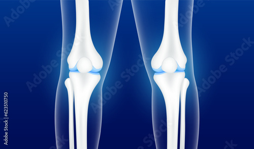 Healthy bone joint knee and cartilage. Human bone leg anatomy on a dark blue background. Medical and science template. Skeleton x ray scan concept. 3D Vector EPS10 illustration. photo