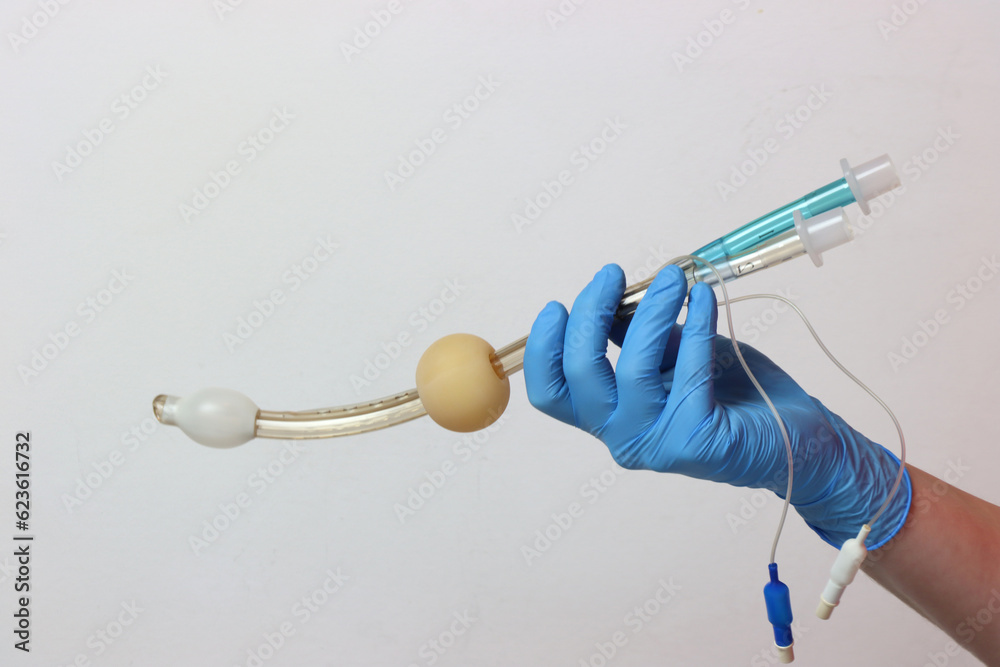 Esophageal tracheal airway tube with both cuffs insuflated in a