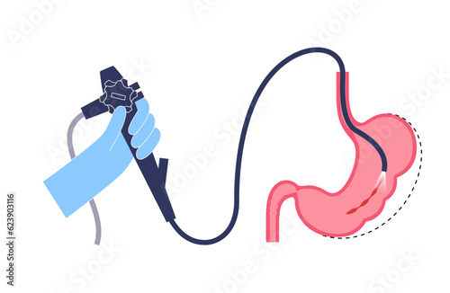 Endoscopic sleeve gastroplasty