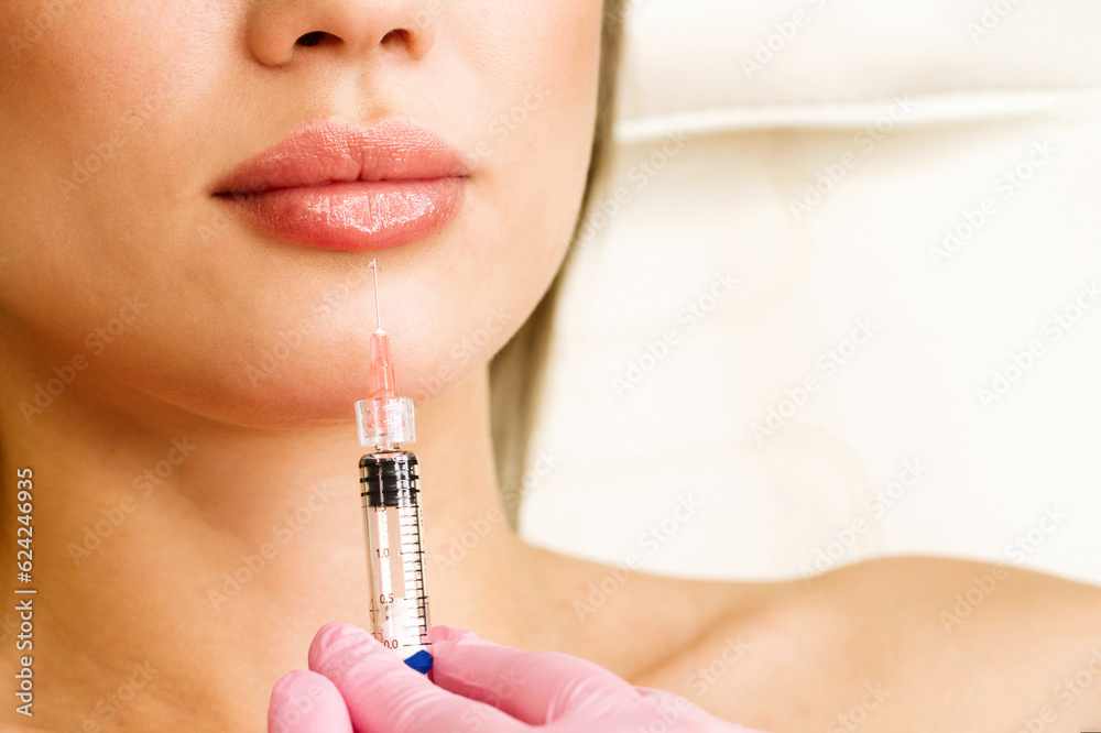 Lip augmentation procedure Lip augmentation procedure