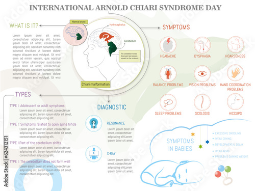Infographic of Arnold Chiari Syndrome, what it is, symptoms and treatment with icons on soft background. photo