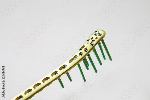 A golden locking plate with screws for treatment bone fractureon a white background photo