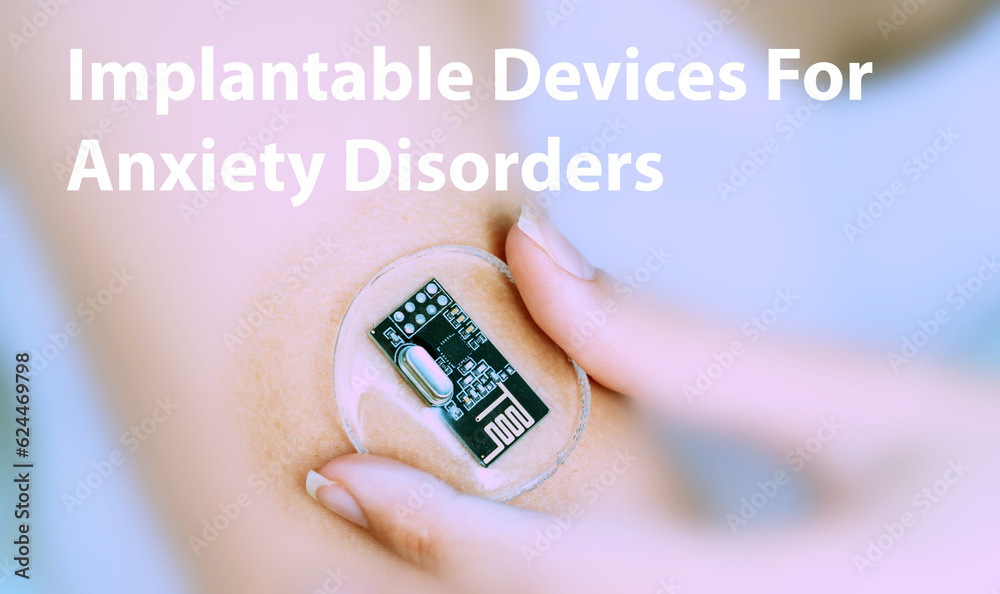 Implantable Devices For Anxiety Disorders Implantable Electronic