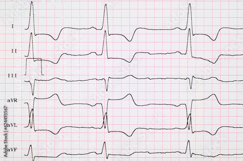 Принти на полотні ECG