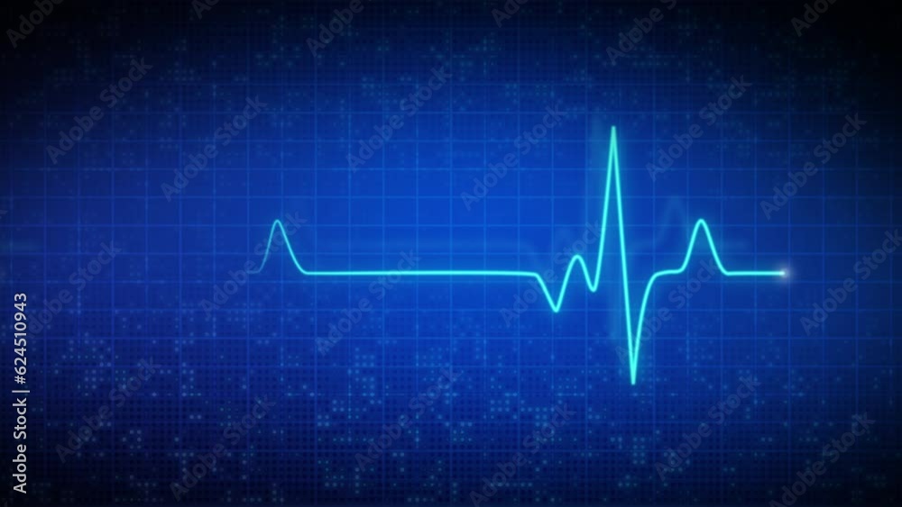 Animation electrocardiogram heartbeat. Display on monitor pulse line. Medical screen with animated looped blue background with grid. Animation electrocardiogram heartbeat. Display on monitor pulse line. Medical screen with animated looped blue background with grid.