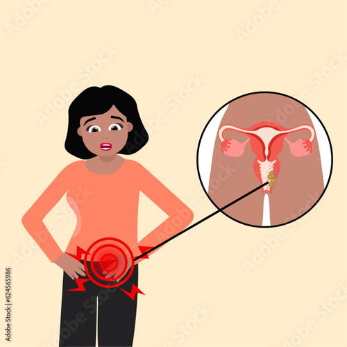Infographic of brown woman's reproductive system disease polyps, fibroids in vector illustration 