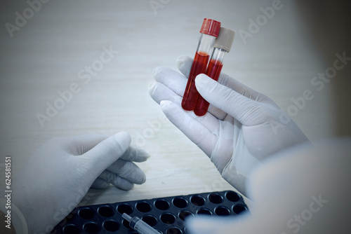 Hand of a doctor holding a bottle of blood sample.