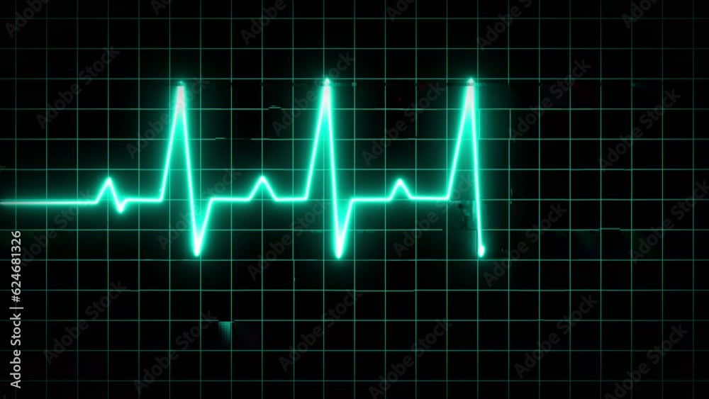 animation of an ecg ekg display. Heart Rate Monitor Electrocardiogram