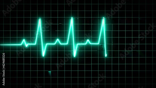 animation of an ecg ekg display. Heart Rate Monitor Electrocardiogram Ekg Or Ecg Looping background