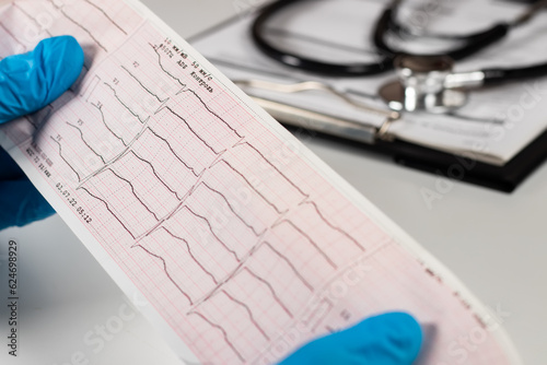 Tableau sur toile Doctor's hands hold result of the cardiogram next to patient sitting