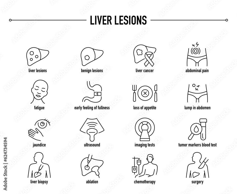 Liver Lesions symptoms, diagnostic and treatment vector icon set. Line editable medical icons. Liver Lesions symptoms, diagnostic and treatment vector icon set. Line editable medical icons.