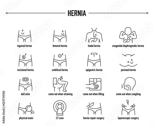 Hernia symptoms, diagnostic and treatment vector icon set. Line editable medical icons. photo