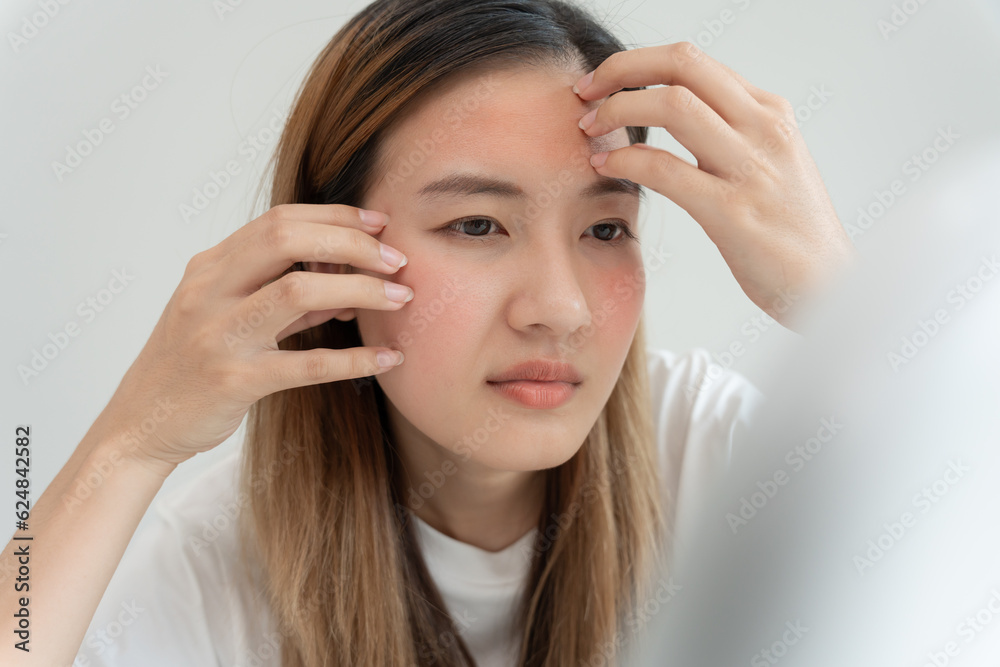 Young woman asian are worried about faces Dermatology and allergic to steroids in cosmetics. sensitive skin, red face from sunburn, acne, allergic to chemicals, rash on face. skin problems and beauty Young woman asian are worried about faces Dermatology and allergic to steroids in cosmetics. sensitive skin, red face from sunburn, acne, allergic to chemicals, rash on face. skin problems and beauty