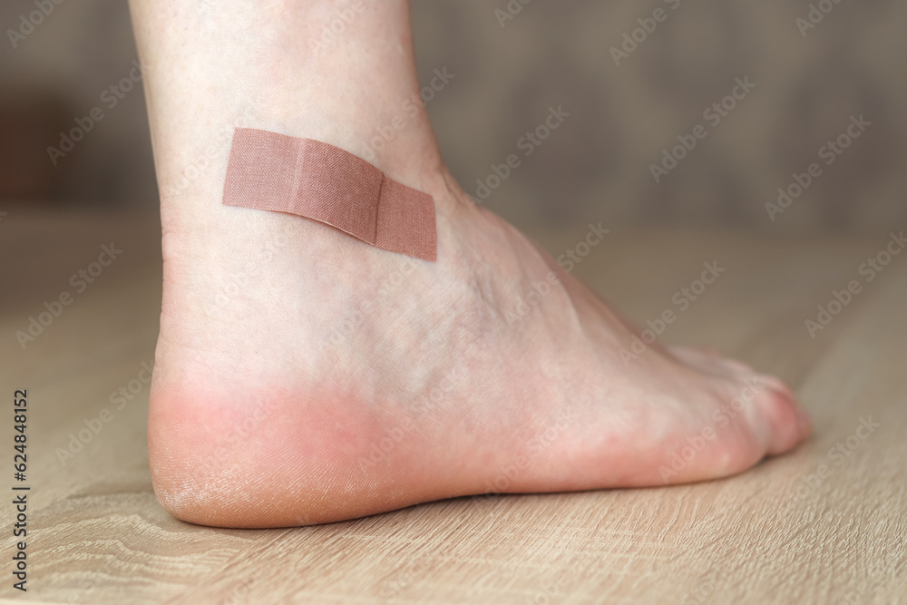 Using bactericidal medical adhesive plaster at home. Foot skin care and
