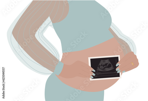 A pregnant woman holds ultrasound results near her tummy. Flat vector illustration on a white background photo
