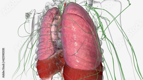 Stage 3 non small cell lung cancer is sometimes called locally advanced cancer