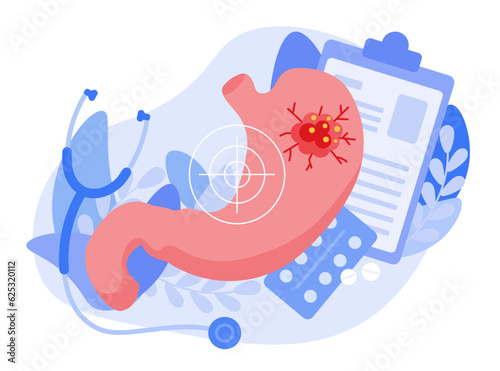 Cancer and inflammation in the stomach. Pain, swelling, disease in the digestive system. The concept of examining internal organs. Medical poster. Vector illustration of abdominal trauma