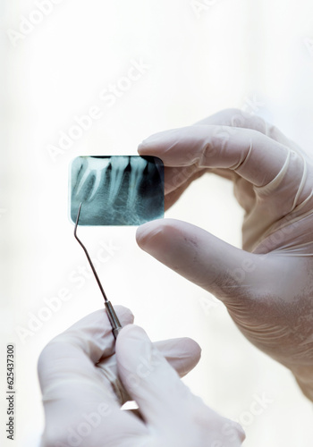 Tooth x-ray being examined by a dentist photo