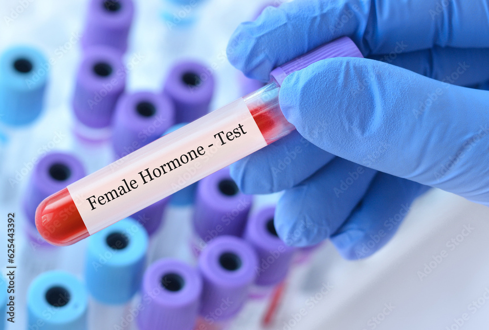 Obraz premium Doctor holding a test blood sample tube with female hormone test on the background of medical test tubes with analyzes.Copy space for text.