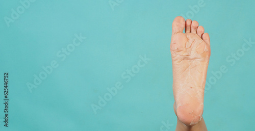 Left Foots peeling or remove dead skin on mint green background.