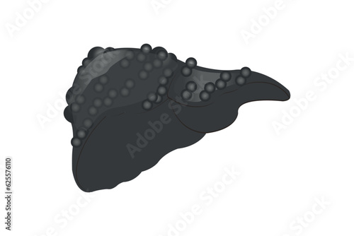 cirrhosis liver illustration isolated on white background. eps 10