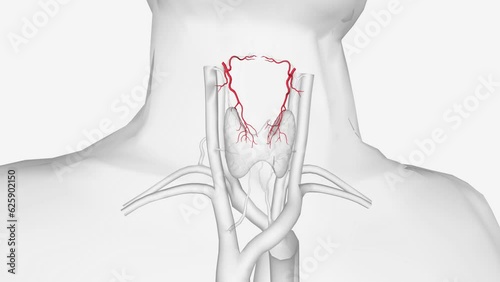 The superior thyroid artery arises from the external carotid artery just below the level of the greater cornu photo