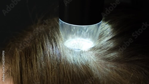 Trichoscopy of hair and scalp close-up. photo