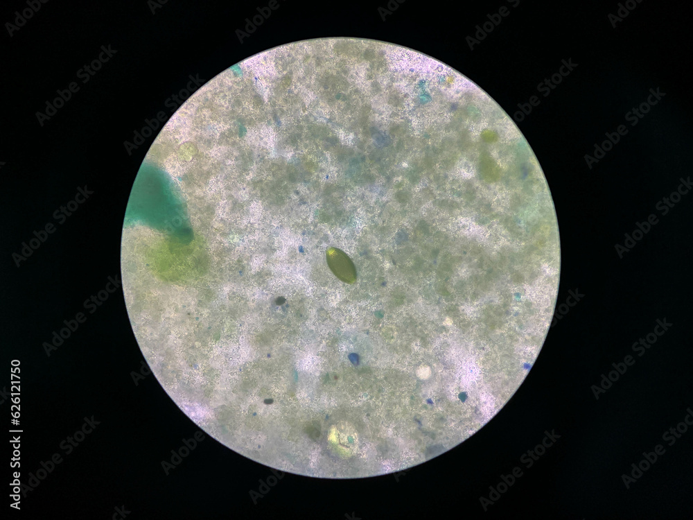 Obraz premium trichuris trichiura egg human parasite in stool or faeces examination test find microscope