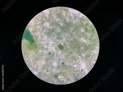 trichuris trichiura egg human parasite in stool or faeces examination test find microscope
