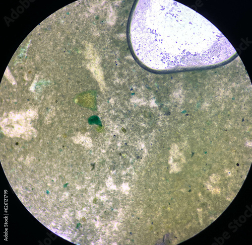 trichuris trichiura egg human parasite in stool or faeces examination test find microscope photo