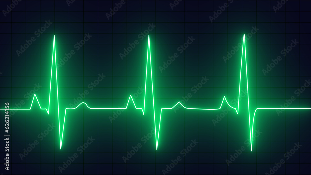Green color EKG heart line monitor. Emergency EKG monitoring. pulse line. ECG heartbeat monitor, cardiogram heart pulse line wave. Electrocardiogram Medical Background.
