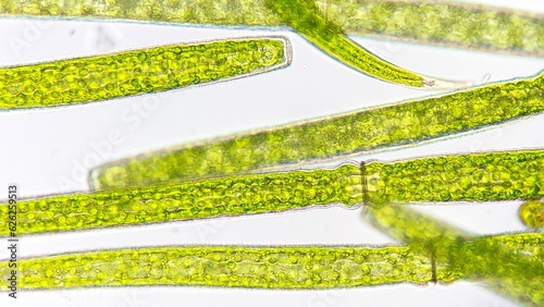 Freshwater microalgae (Pleurotaenium sp.) blooming under microscope. 760x magnification. Sampel was taken on July 8, 2023 (dry season). Location: Bogor regency, Indonesia