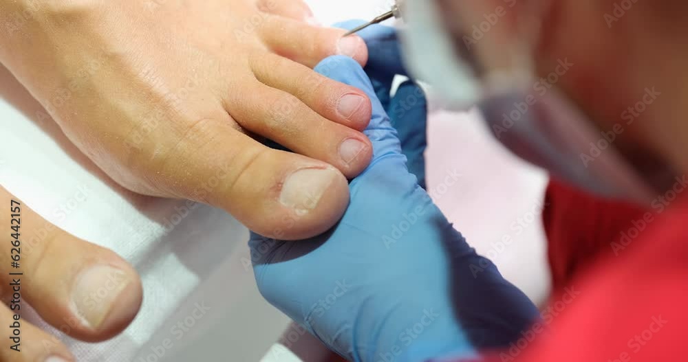 The master of manicure makes a female pedicure in blue gloves, a close-up. Removing burrs on the fingers