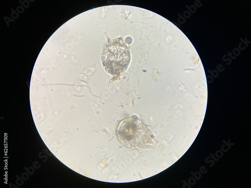 Notoedres cati under the microscope. Notoedric mange, also referred to as Feline scabies, is a highly contagious skin infestation caused by an ectoparasitic and skin burrowing mite Notoedres cati. photo