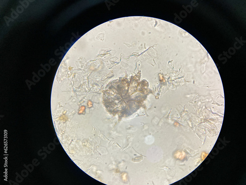 Notoedres cati under the microscope. Notoedric mange, also referred to as Feline scabies, is a highly contagious skin infestation caused by an ectoparasitic and skin burrowing mite Notoedres cati. photo