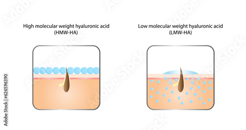 Hyaluronic acid.  Difference between Low molecular and High molecular hyaluronic acid.  anti-aging therapy, skincare products. Vector illustration. 