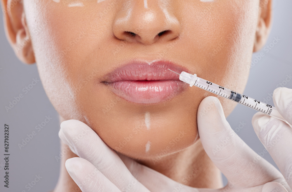 Closeup, lip filler and botox with woman and injection for plastic surgery, dermatology and beauty. Pattern, aesthetic and medical with model and syringe on grey background for collagen and cosmetics