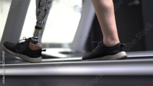 Woman with prosthetic leg using walking on a treadmill while working out in the gym. photo