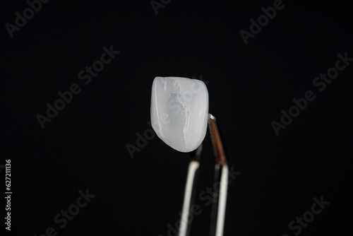 фотографія Ceramic Veneer Dental Smile design White teeth Close-up super thin porcelain laminated veneer measurement with a vernier caliper to show the thickness or smile makeover treatment