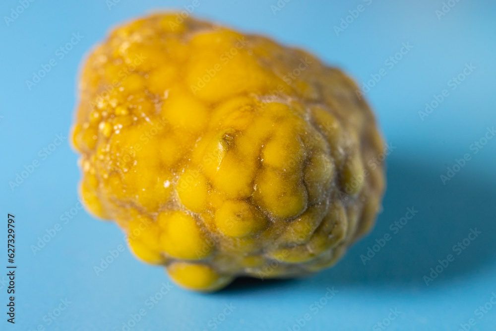 how-to-get-rid-of-gallstones-naturally-gallbladder-cleanse