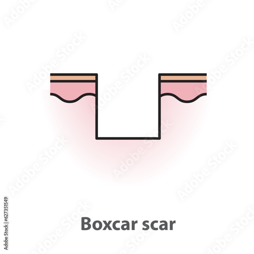 Boxcar scar, atrophic scar, type of acne scar on skin surface with color and line vector isolated on white background. Skin care and beauty concept. Flat icon illustration.