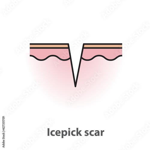  Icepick scar, atrophic scar, type of acne scar on skin surface with color and line vector isolated on white background. Skin care and beauty concept. Flat icon illustration.