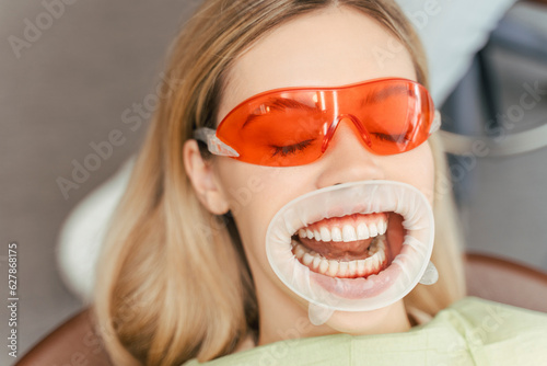 Beautiful woman with blonde hair in red glasses with open mouth sitting in dental chair, whitening