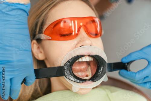 Beautiful woman with blond hair sitting in dental chair with mouth open, wearing red glasses